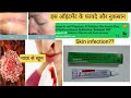 Neosporin h cream uses in hindi | Neosporin h ointment uses in nose bleeding | Neosporin h cream use