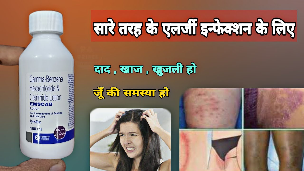 gamma benzene hexachloride cetrimide lotion emscab lotion khujli ka