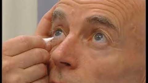 MRCP PACES Fifth Cranial Nerve