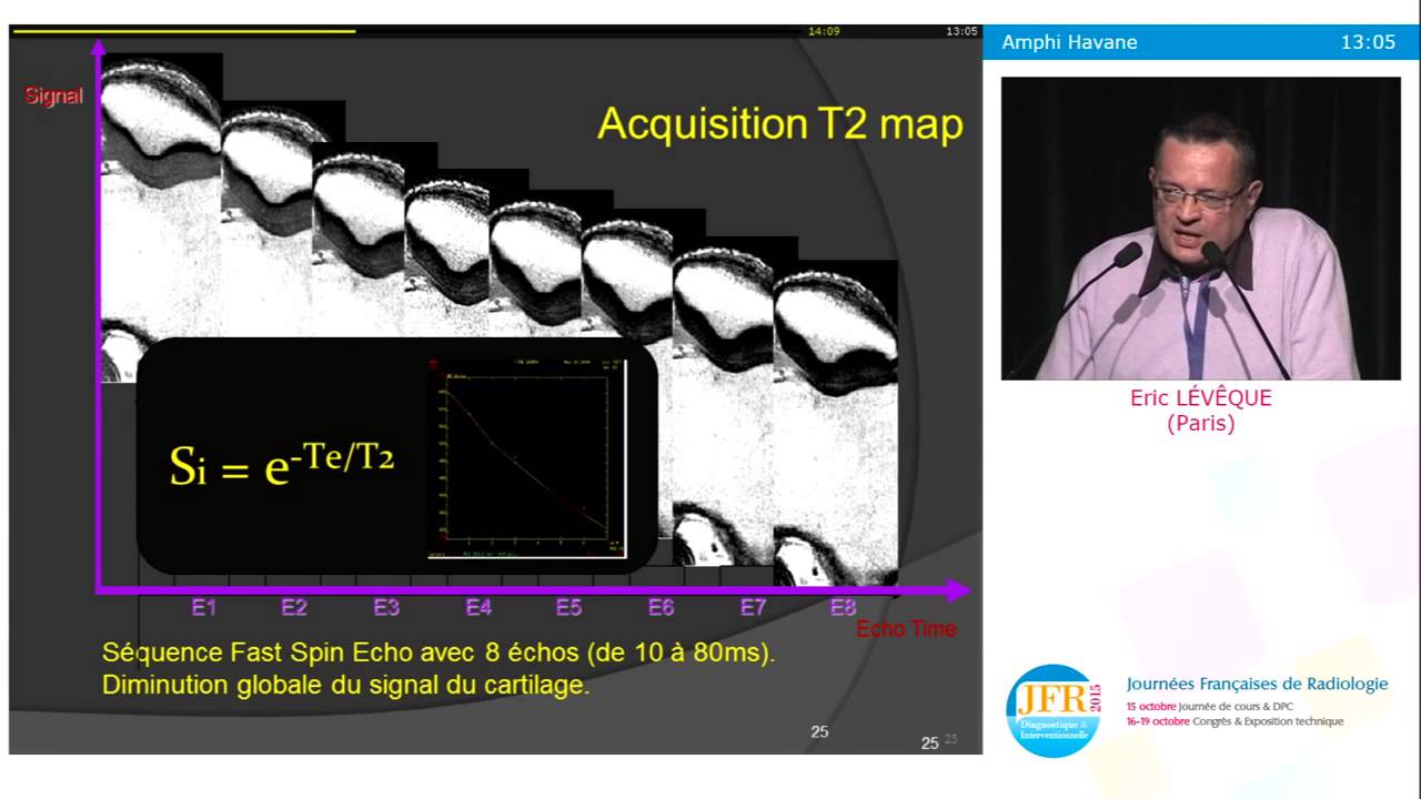 Imagerie du cartilage avec Olea Sphere