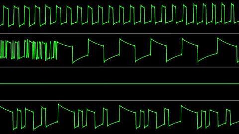 Bryan Ness (Tobikomi)  - "Missile Command: Theta" [Atari 8-bit] (Chiptune Visualization)