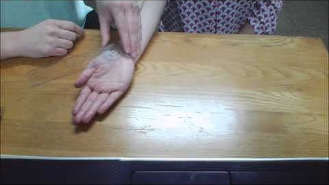 Carpometacarpal (CMC) Extension of Thumb ROM