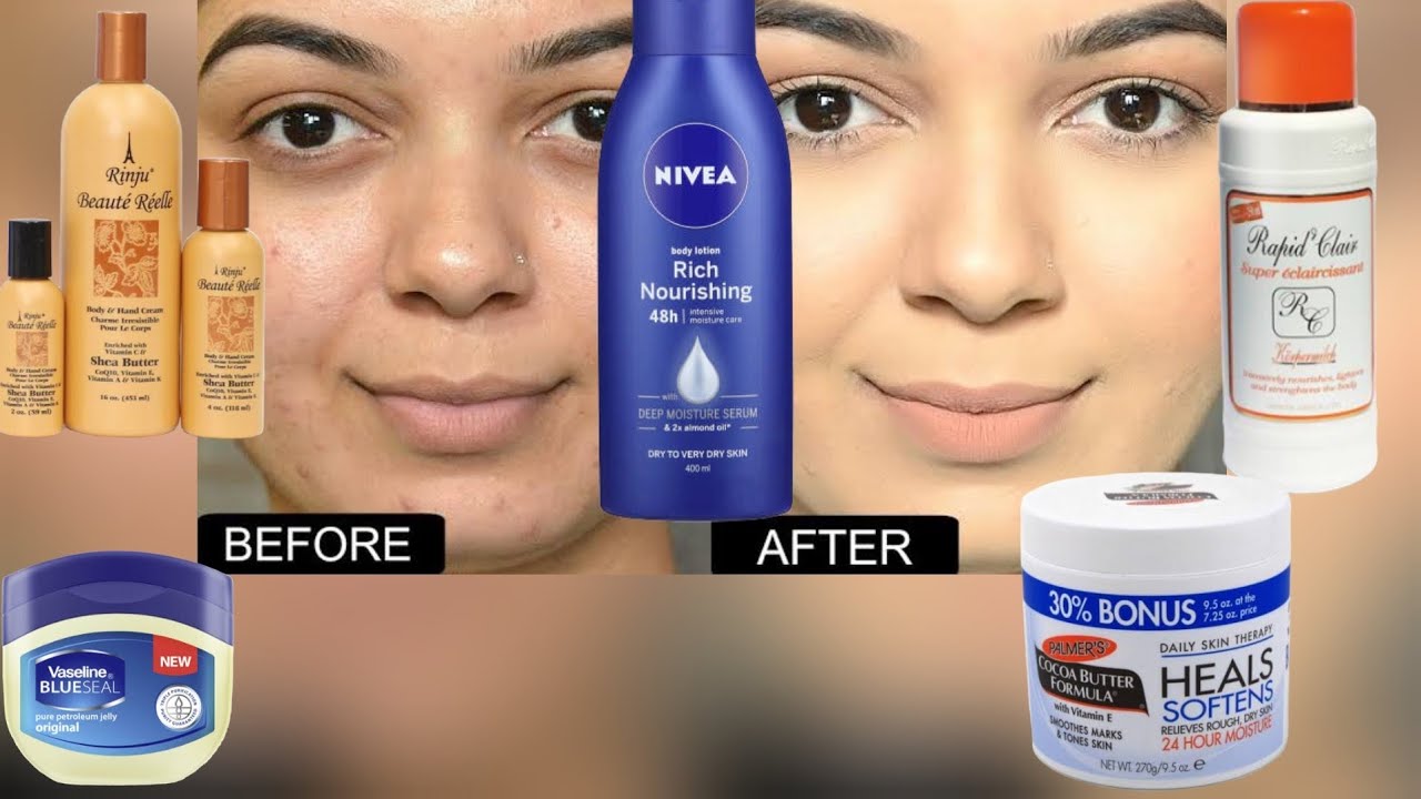 Ondoa VITUNDU USONI Epuka MAFUTA HAYA Mambo HATARI kwa AFYA ya