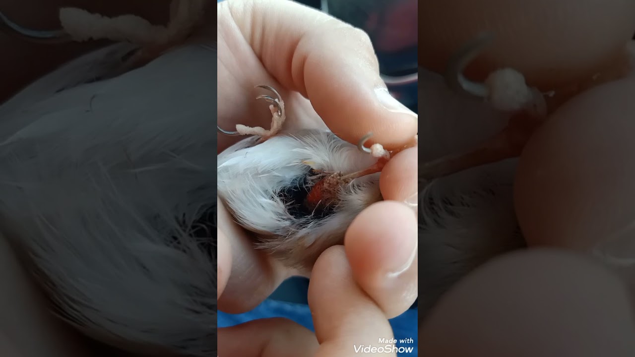 تجبير فخذ الحسون ✅