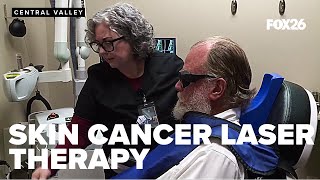 Fresno clinic offers alternative to surgery for skin cancer with 99 3 cure rate