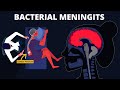 Bacterial Meningitis : Symptoms, Diagnosis, Treatments & Pathology