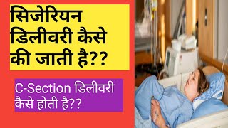 सिजेरियन (Cessarian)डिलीवरी कैसे की जाती है?? C-Section delivery process in detail