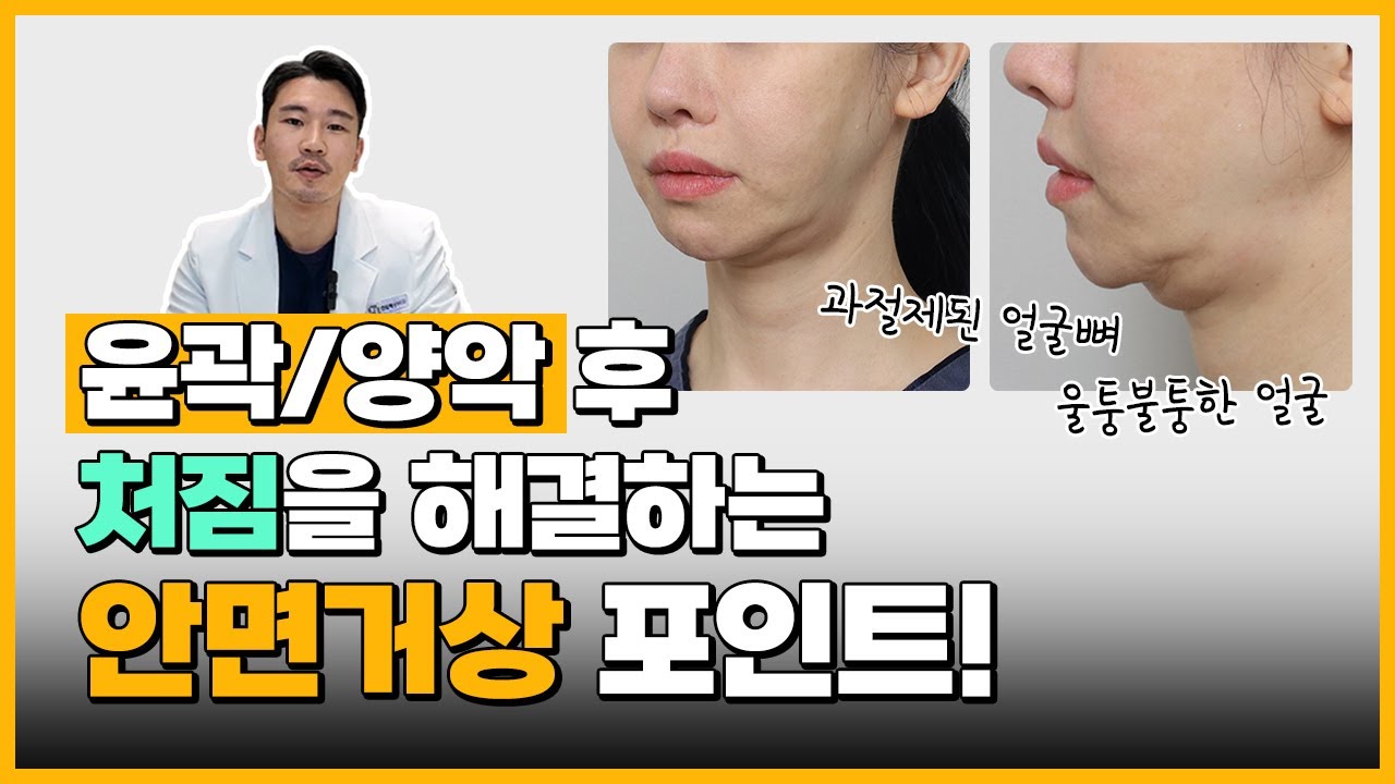 양악, 윤곽수술 후 처짐이 생기는 이유, 안면거상 고민 중이라면 필수시청🔥