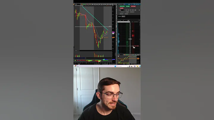 FASTEST Way To Set A Stop-Loss ThinkorSwim #thinkorswim #daytrading #shorts #teambull