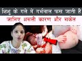 गर्भ में बच्चे के गले में गर्भनाल क्यों लिपट जाती है 7-8-9वें महीने में जाने कारण Cord Around Neck
