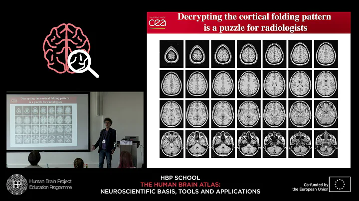Mangin Jean-Francois - Deciphering the cortical fo...