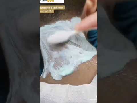 تفتيح سواد الرقبة