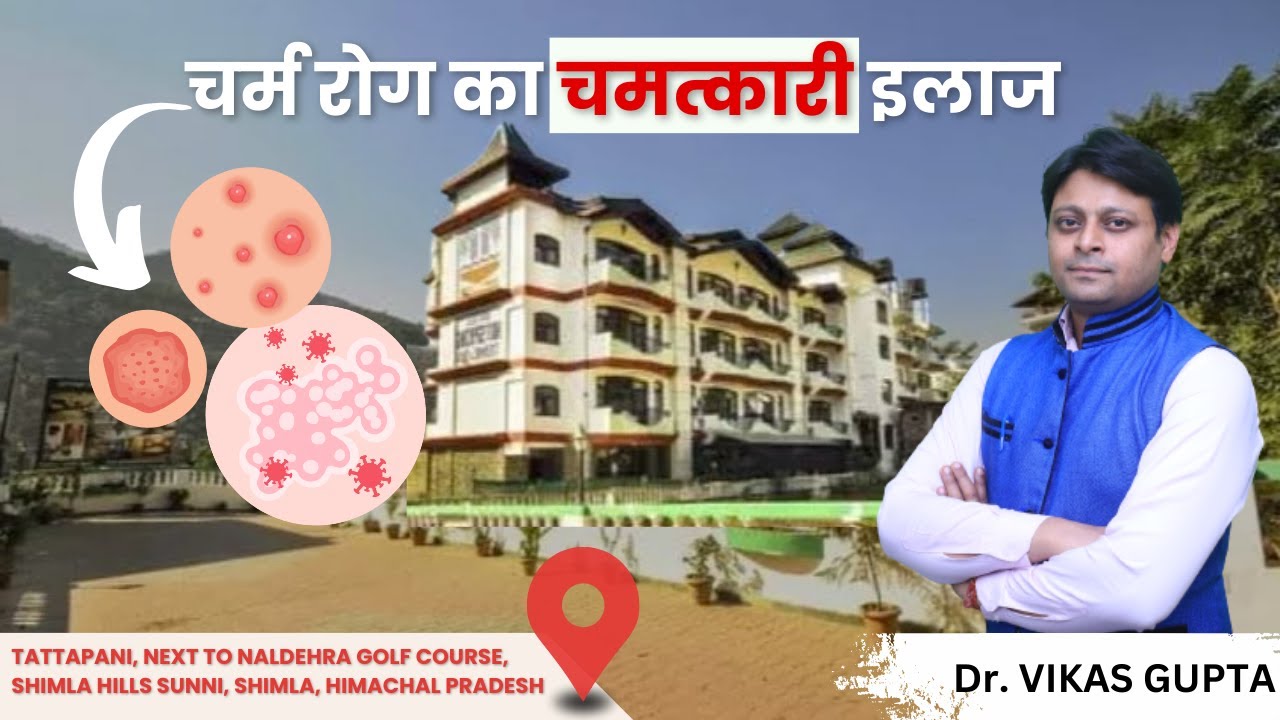 संध्या हॉट स्प्रिंग चर्म रोग का चमत्कारी इलाज || Sandhya Hot Spring  || Sandhya Medicity