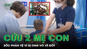 Thành công cứu 2 mẹ con bị sốc phản vệ do ong vò vẽ đốt | SKĐS