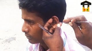 ►A Village Guys 1st Time Earwax Cleaning at Town Area II Street Earwax Removal BD