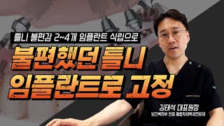 2~4개 임플란트 식립으로 틀니 불편감 덜어
