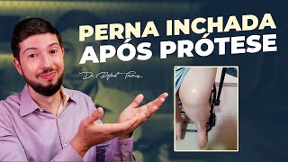 Por que a Perna Incha após a prótese? | Dr Rafael Tavares - Quadril