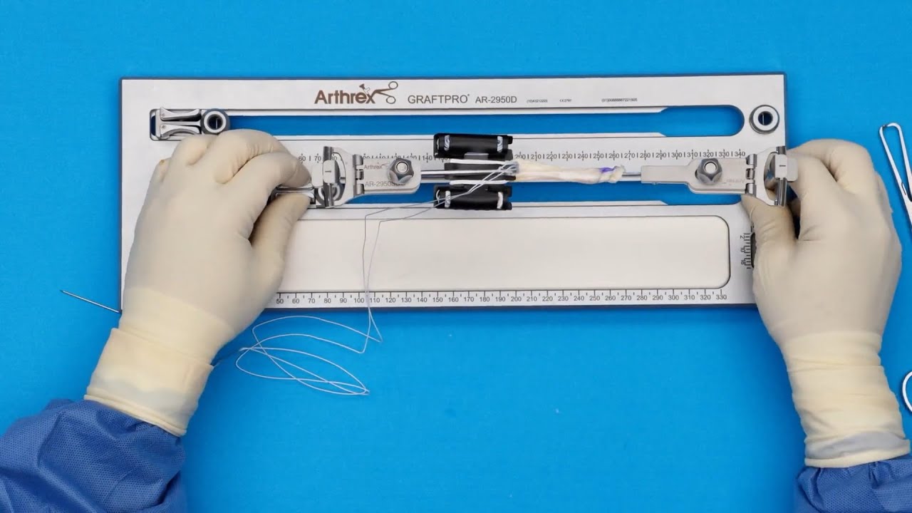 Tendon Slides Instrument Quad Tendon Graft Preparation Using Sliding GraftClamp Instruments ...