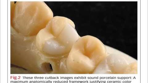 Bench Mastery: Pressing vs. layering
