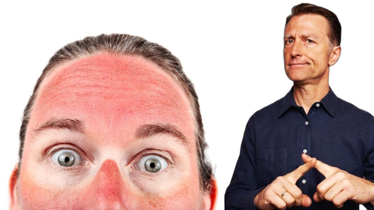 واقي شمسي طبيعي استخدموه لزيادة فيتامين د من الشمس وحماية البشرة من الحروق وسرطان الجلد