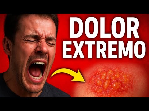 The 7 Most Painful Diseases in the World (Scientifically Proven)