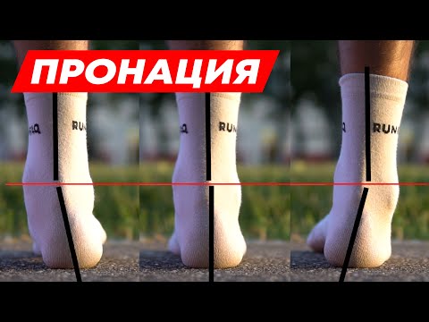 ПРОНАЦИЯ! а также все из нее вытекающее. Гиперпронация / Гипопронация / Супинация / Плоскостопие.