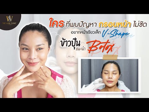 BOTOX กราม สยบปัญหาหน้า U