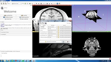 2.  3D Slicer - Saving