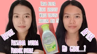 REVIEW OVALE FACIAL LOTION 2 IN 1 OIL CONTROL ANTI ACNE