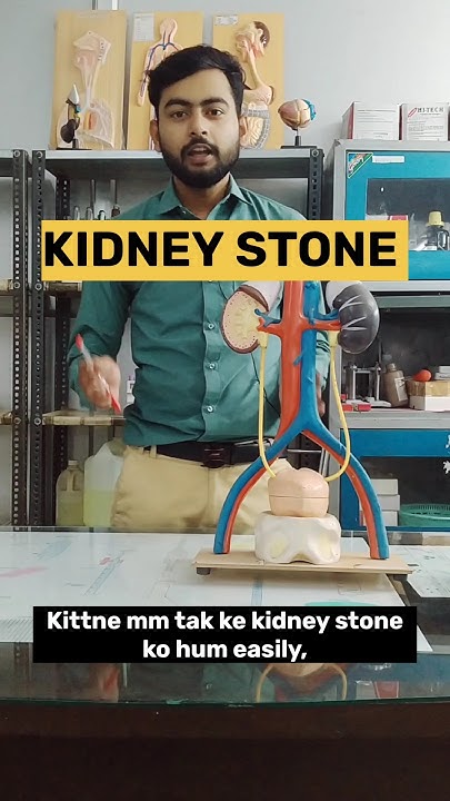 Kidney Stone how Many MM Kidney Stone Passout Through Urine By kidney-stone-how-many-mm-kidney-stone-passout-through-urine-by