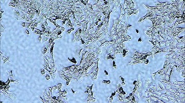 V2 live cell imaging with my self made usb microscope, ok its with fixed cells