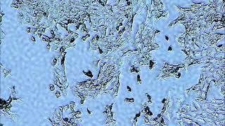 V2 live cell imaging with my self made usb microscope, ok its with fixed cells