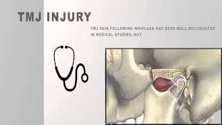 Whiplash Injuries That Can Be Disabling