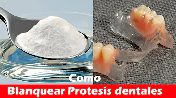 ¿El bicarbonato y el peróxido blanquean las dentaduras postizas?