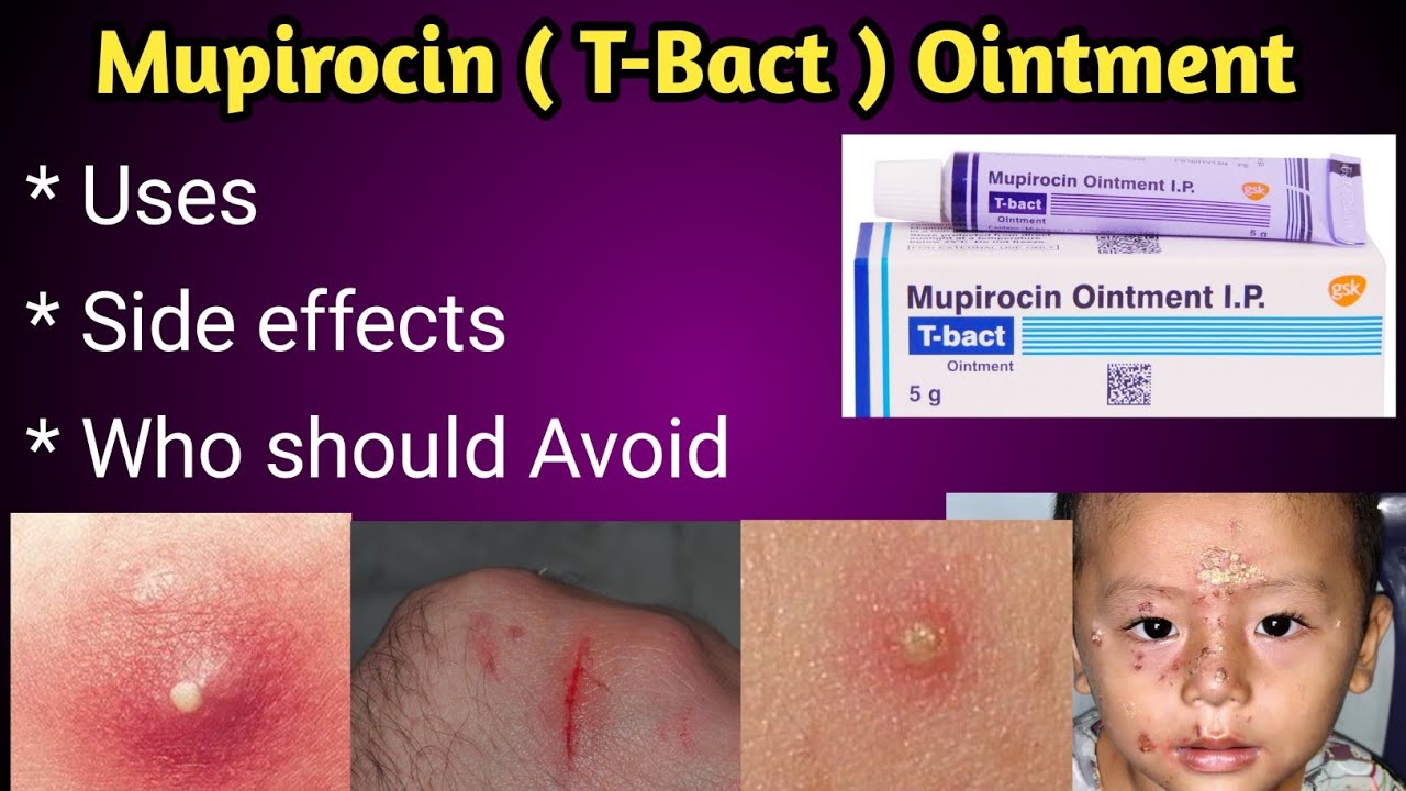 Mupirocin ( T-Bact ) Ointment uses and Side effects.