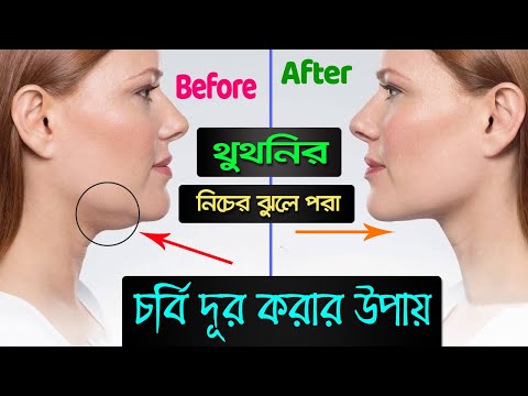 ভিডিও: বমিকে উত্তেজিত করার 3 টি উপায়