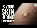I Tell Secrets Hidden Beneath Biopsy explained