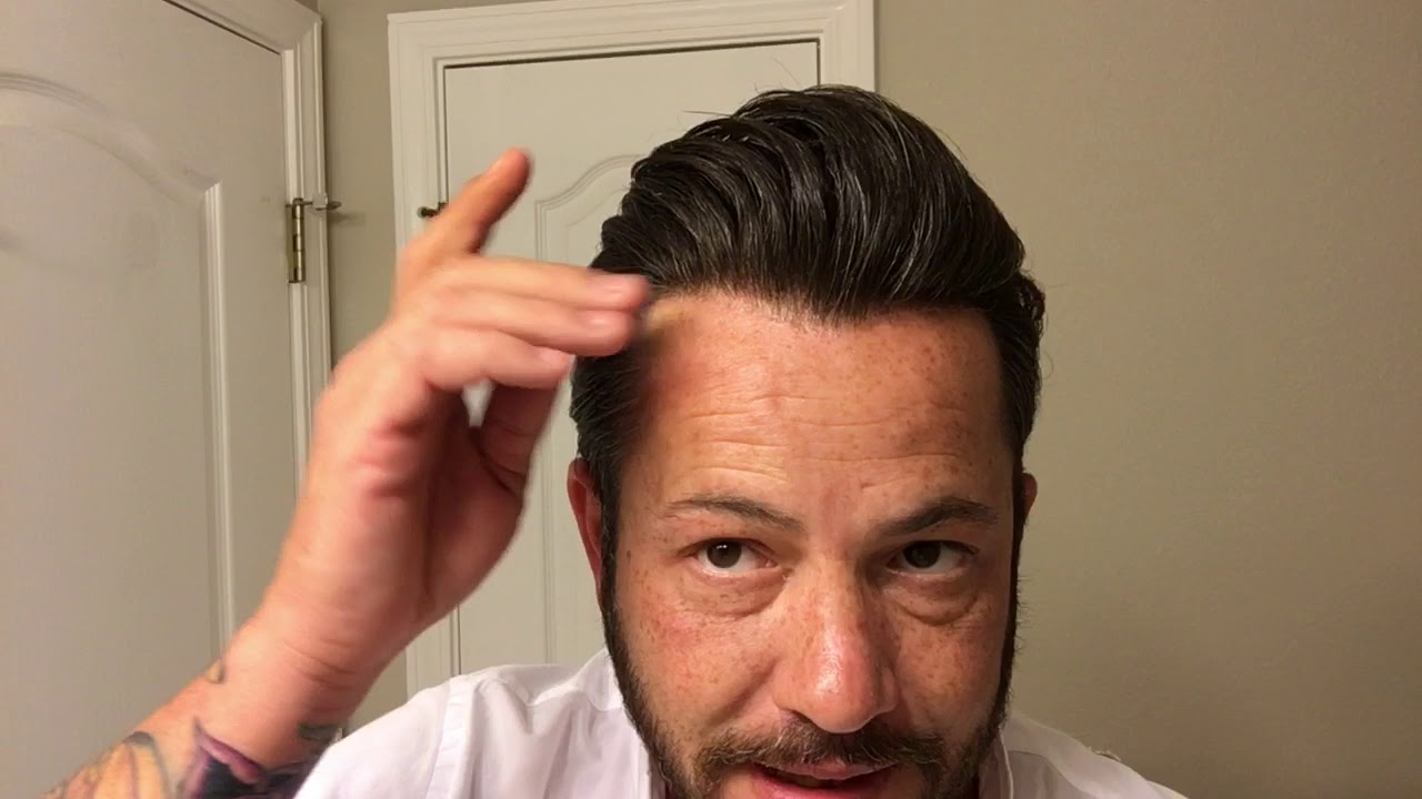 When is your Hairline Ready to be Redone? Also some ranting.  Hair Systme and Hair Replacement