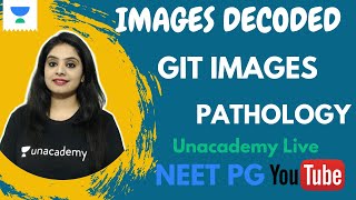IMAGES DECODED | EPS 2 | GIT PATHOLOGY | MUST KNOW IMAGES IN PATHOLOGY | DR. PREETI SHARMA screenshot 5