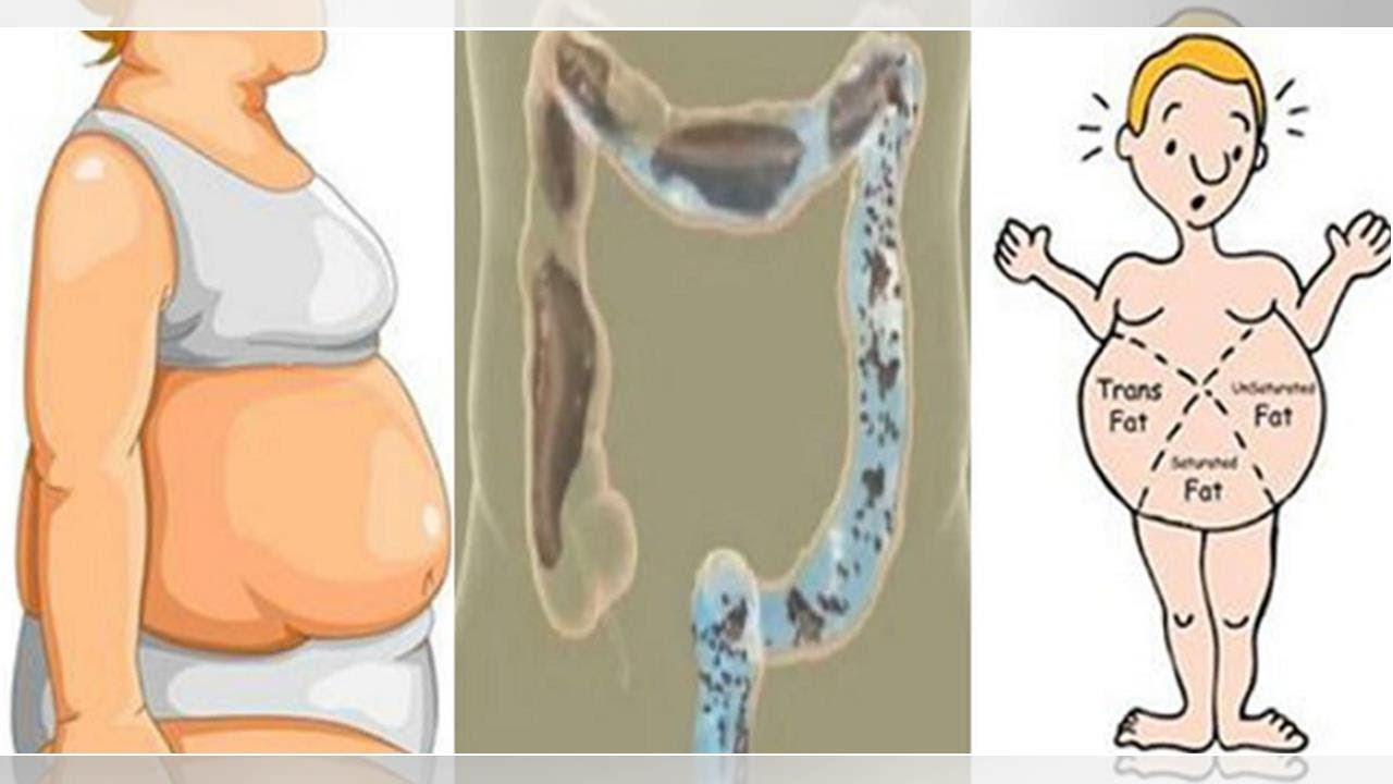 Vous souffrez d'un estomac gonflé ? Voici comment dire adieu à la