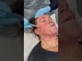 Repairing ACNE SCARING WITH MICRO NEEDLING-Subscribe below for more -Amanda