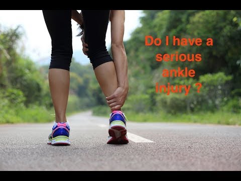 Do I Have A Serious Ankle Injury? - YouTube