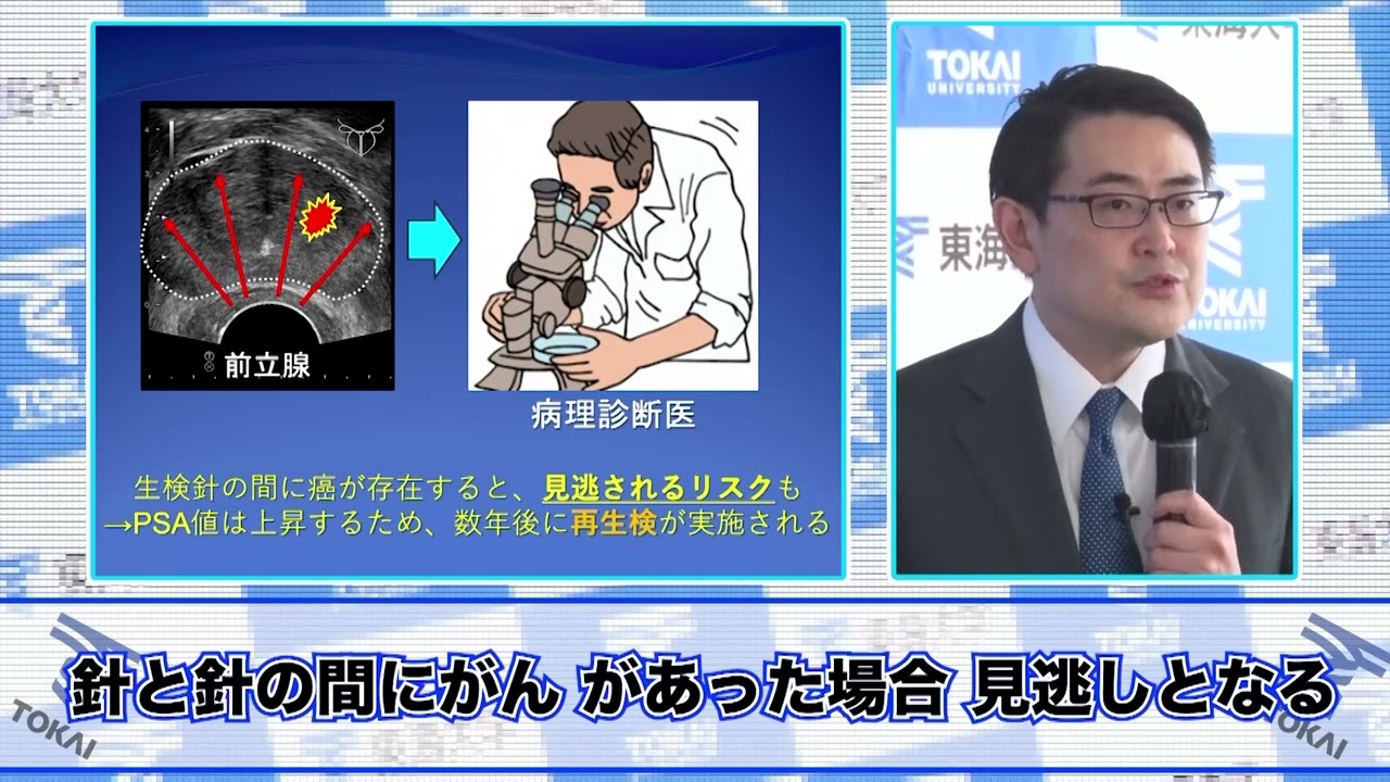 【東海大学】「高密度焦点式超音波療法を用いた前立腺癌標的局所療法」（先進医療B認定）に関するプレスセミナー