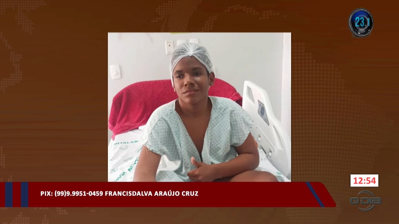 Mãe pede ajuda ao programa Rota do Dia para tratamento de filho com hidrocefalia 08 09 2023