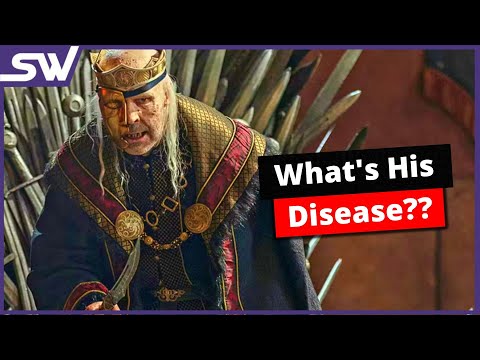 House of the dragon: What Disease is Viserys Suffering From?