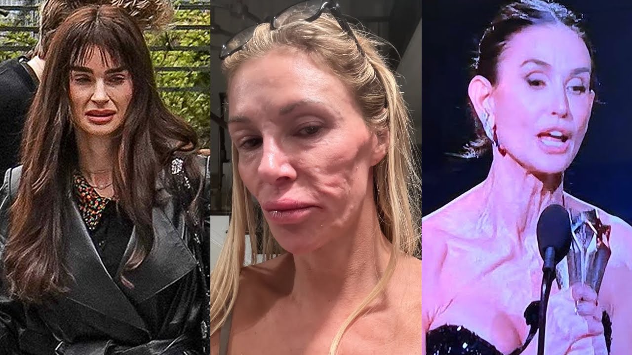 Запрещенные кадры показывают, как компания Ozempic РАЗРУШАЕТ тела знаменитостей.