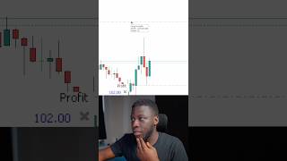 The Reason I Love Scalping In 10 Seconds | This Is Priceless 🔥🔥
