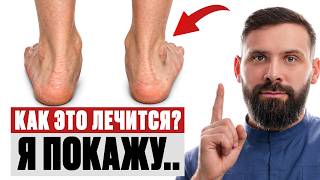 Как укрепить свод стопы если болят колени и тазобедренный сустав