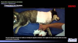Cabestrillo de Velpeau | Demo