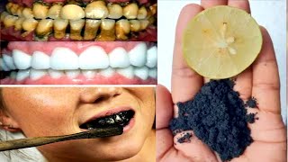 3 मिनट में पीले दाँतों को मोतियों की तरह सफेद बना देगा ये नुस्खा | Teeth Whitening | Whiten Teeth